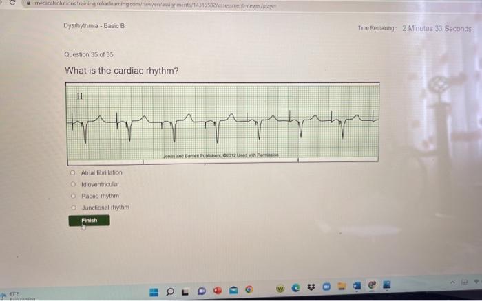 Dysrhythmia - advanced with measurements a