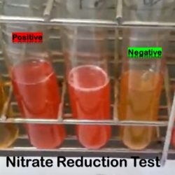 Nitrate test microbiology reduction negative lab nitrite mr urease vp does practical look easynotecards