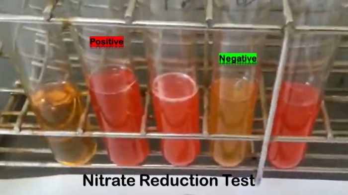 Nitrate test microbiology reduction negative lab nitrite mr urease vp does practical look easynotecards