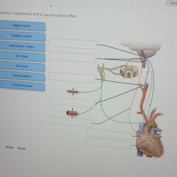 Label the components of the baroreceptor reflex