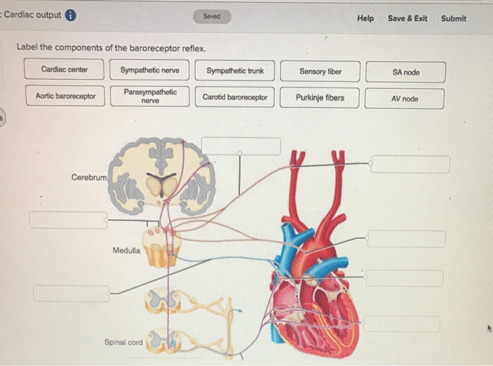 Label the components of the baroreceptor reflex